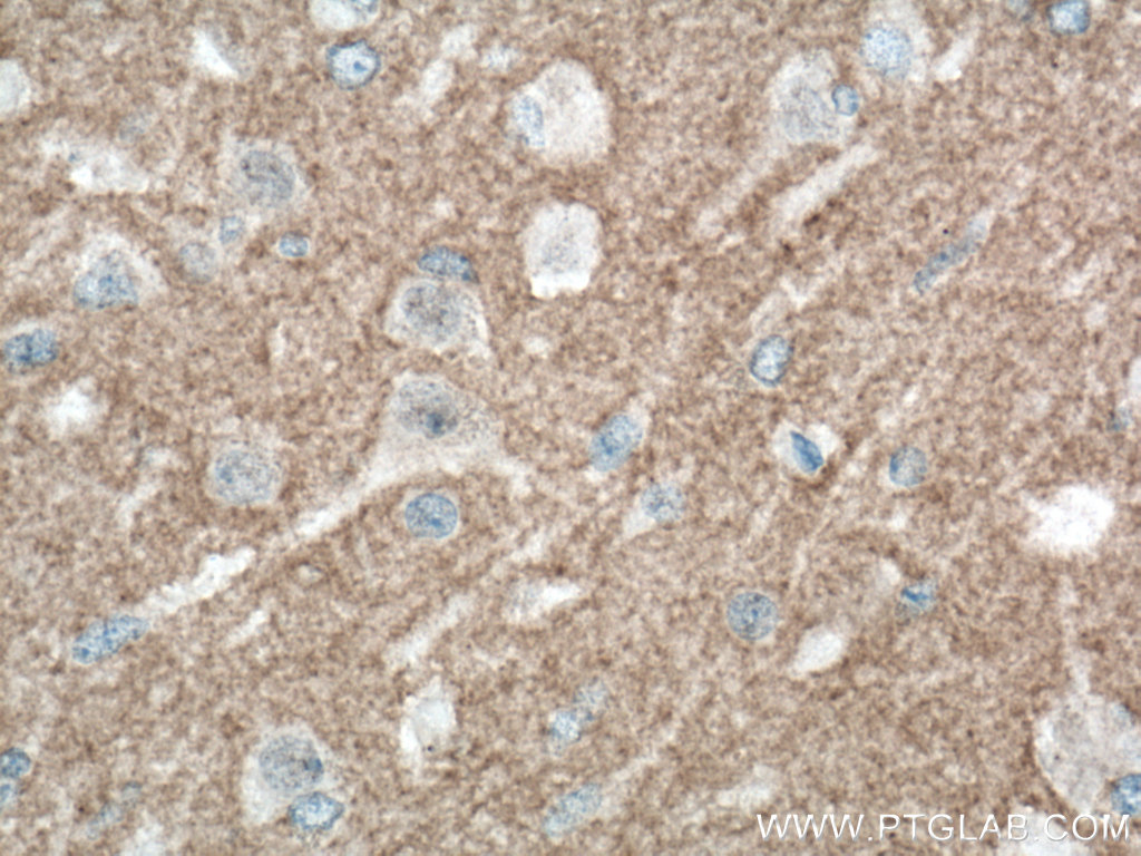 IHC staining of human brain using 67115-1-Ig