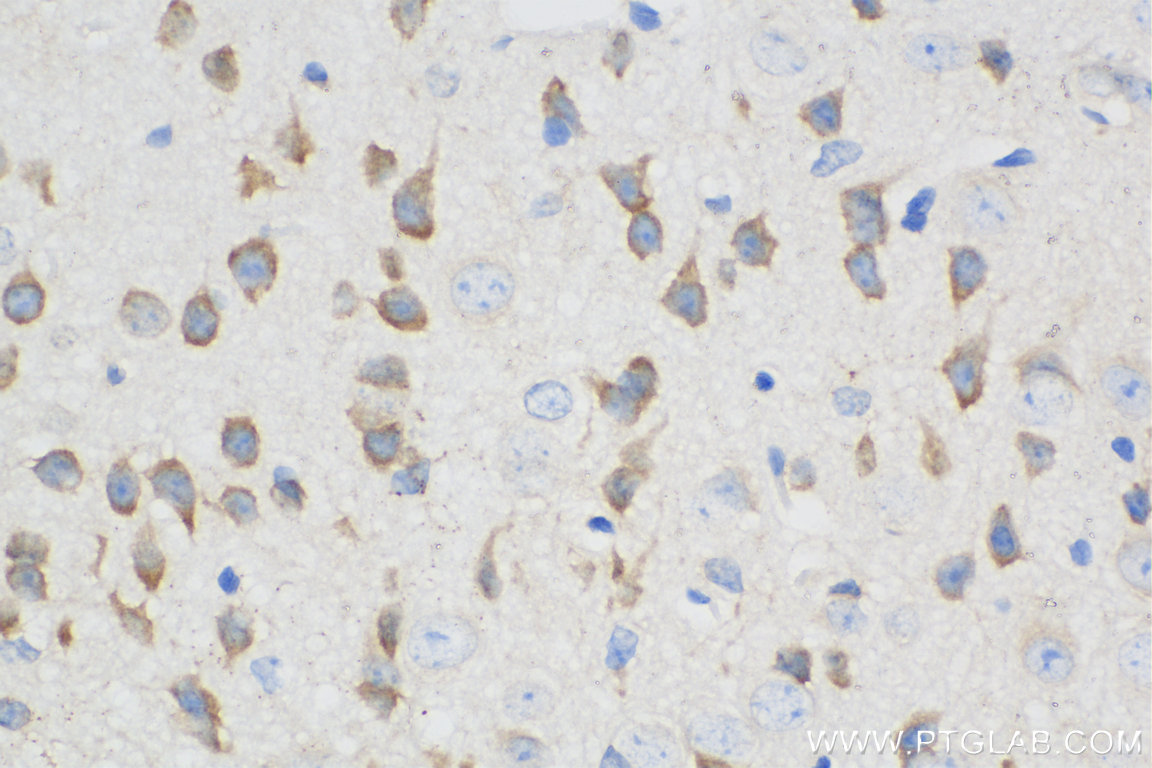 IHC staining of mouse brain using Biotin-67115