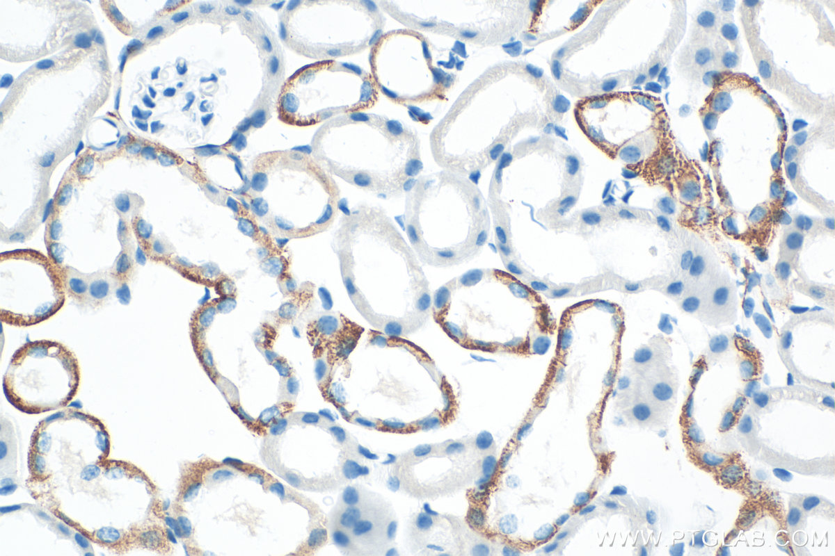 Immunohistochemical analysis of paraffin-embedded mouse kidney tissue slide using 86305-2-RR (L1CAM/CD171 antibody) at dilution of 1:400 (under 40x lens). Heat mediated antigen retrieval with Tris-EDTA buffer (pH 9.0). IHC staining of mouse kidney using 86305-2-RR