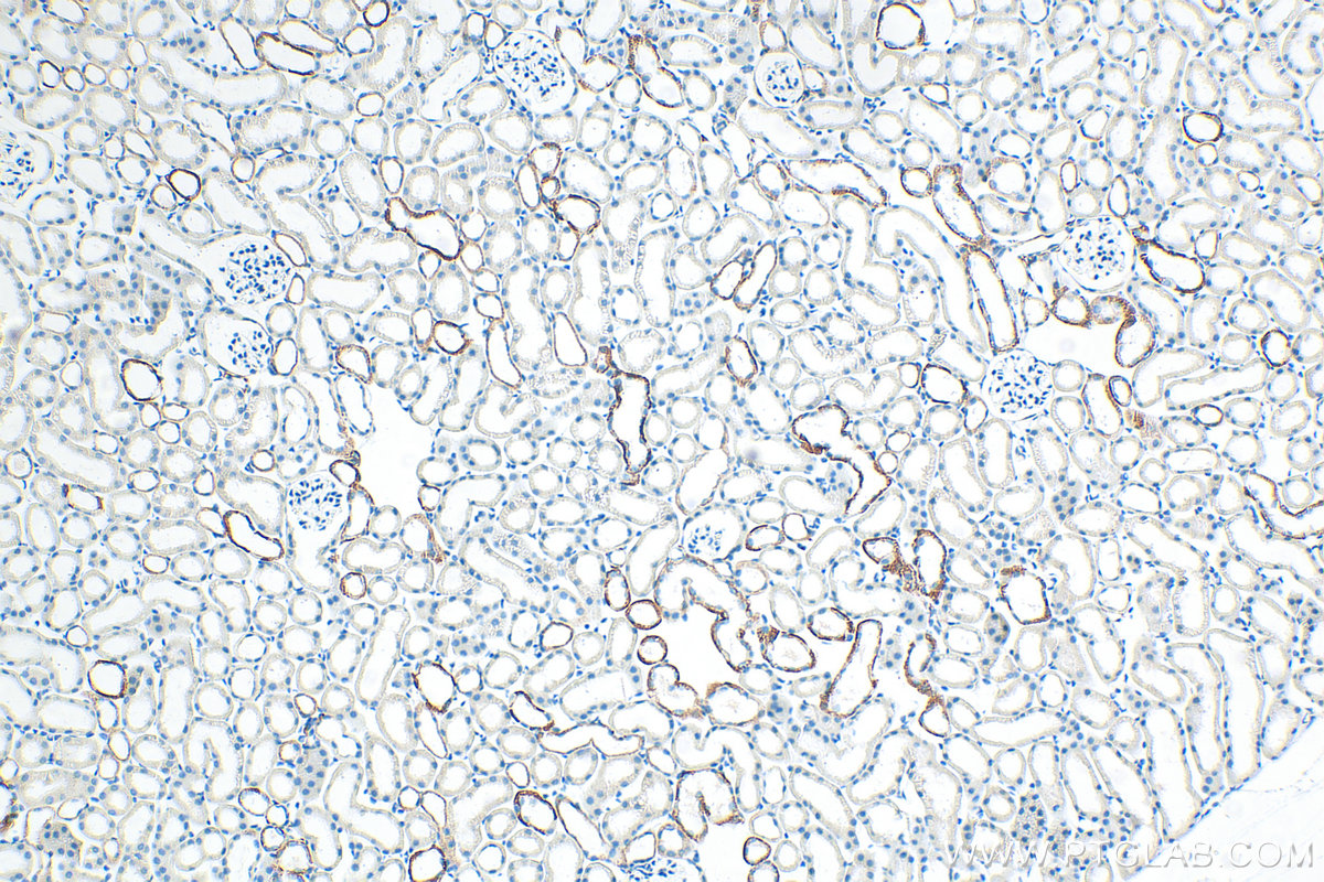 Immunohistochemical analysis of paraffin-embedded mouse kidney tissue slide using 86305-2-RR (L1CAM/CD171 antibody) at dilution of 1:400 (under 10x lens). Heat mediated antigen retrieval with Tris-EDTA buffer (pH 9.0). IHC staining of mouse kidney using 86305-2-RR