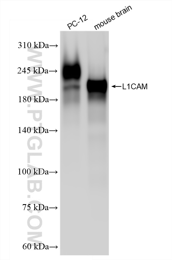 Various lysates were subjected to SDS PAGE followed by western blot with 86305-2-RR (L1CAM/CD171 antibody) at dilution of 1:20000 incubated at room temperature for 1.5 hours. WB analysis using 86305-2-RR