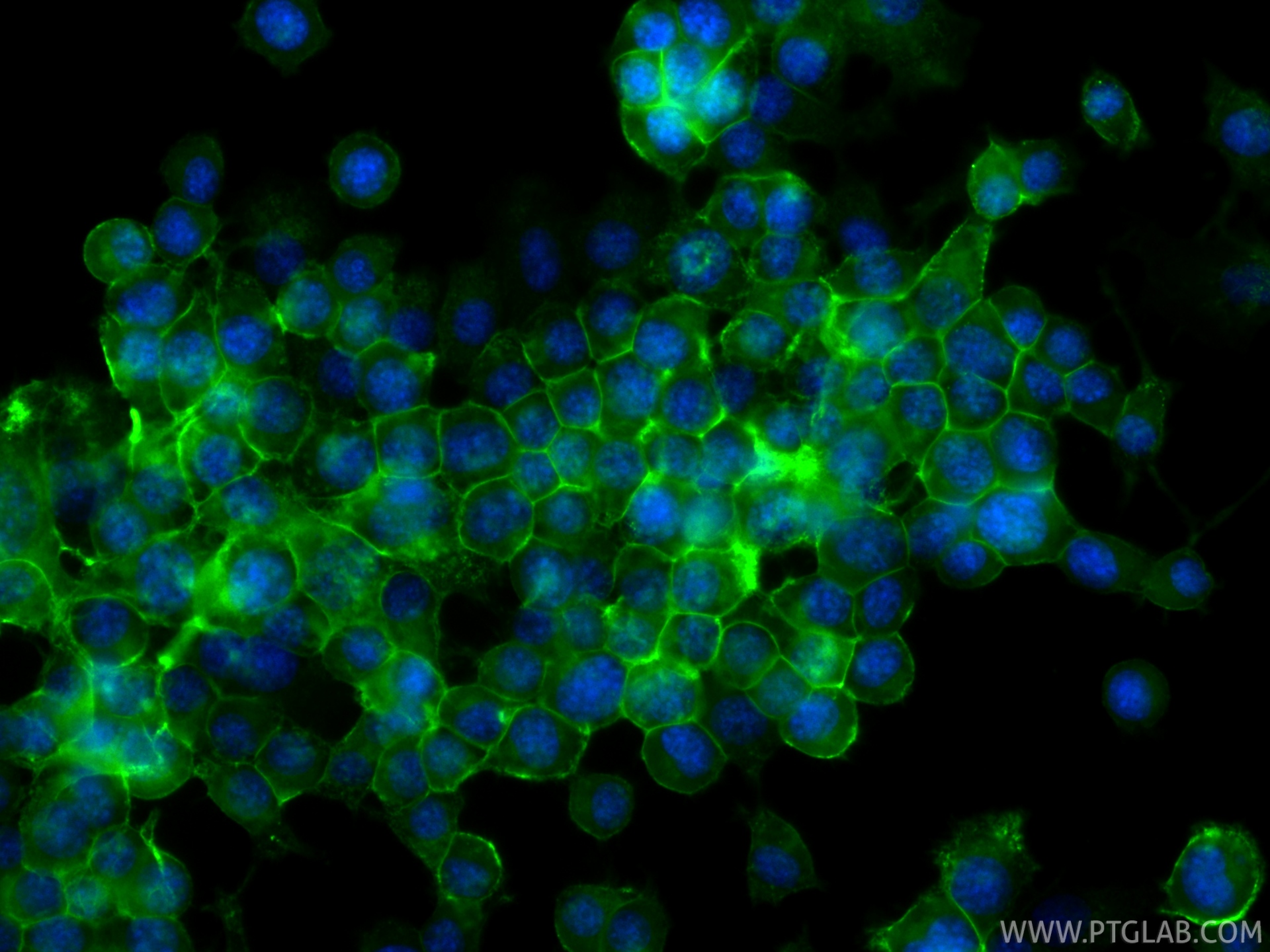 IF Staining of Neuro-2a using CL488-86305-2 IF Staining of Neuro-2a using CL488-86305-2