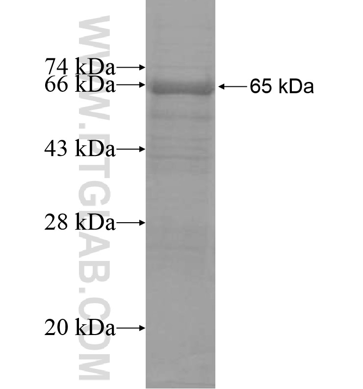 L1CAM fusion protein Ag16249 SDS-PAGE L1CAM fusion protein Ag16249 SDS-PAGE