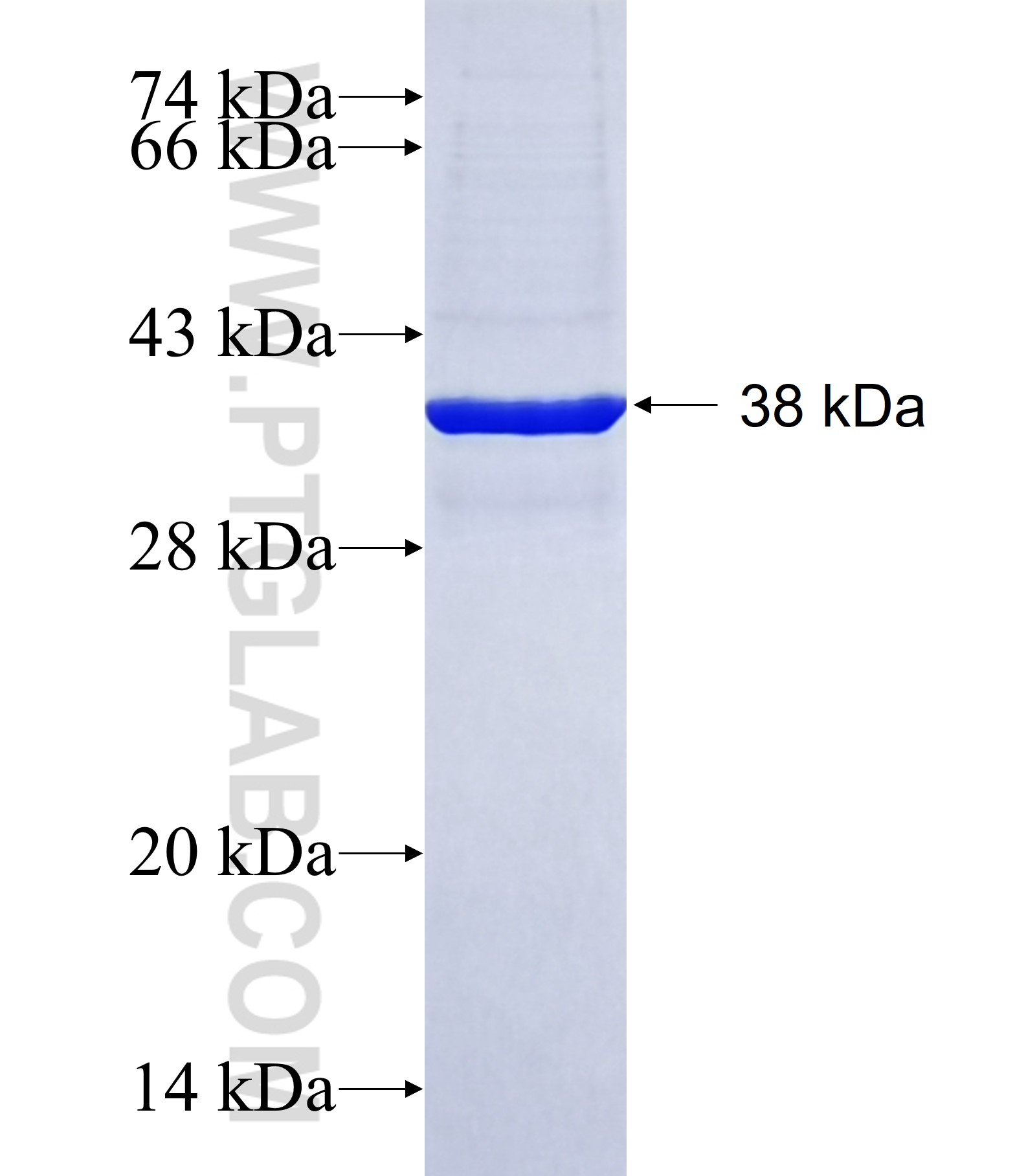 L1RE1 fusion protein Ag40879 SDS-PAGE