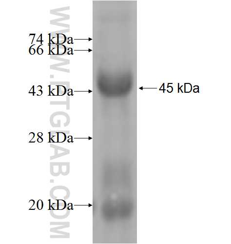 L3MBTL3 fusion protein Ag6020 SDS-PAGE L3MBTL3 fusion protein Ag6020 SDS-PAGE