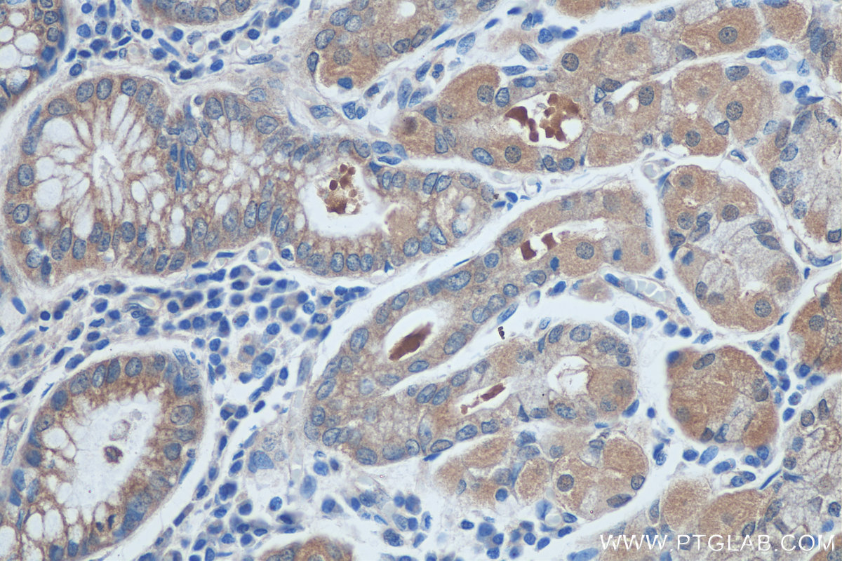 IHC staining of human stomach using 26280-1-AP