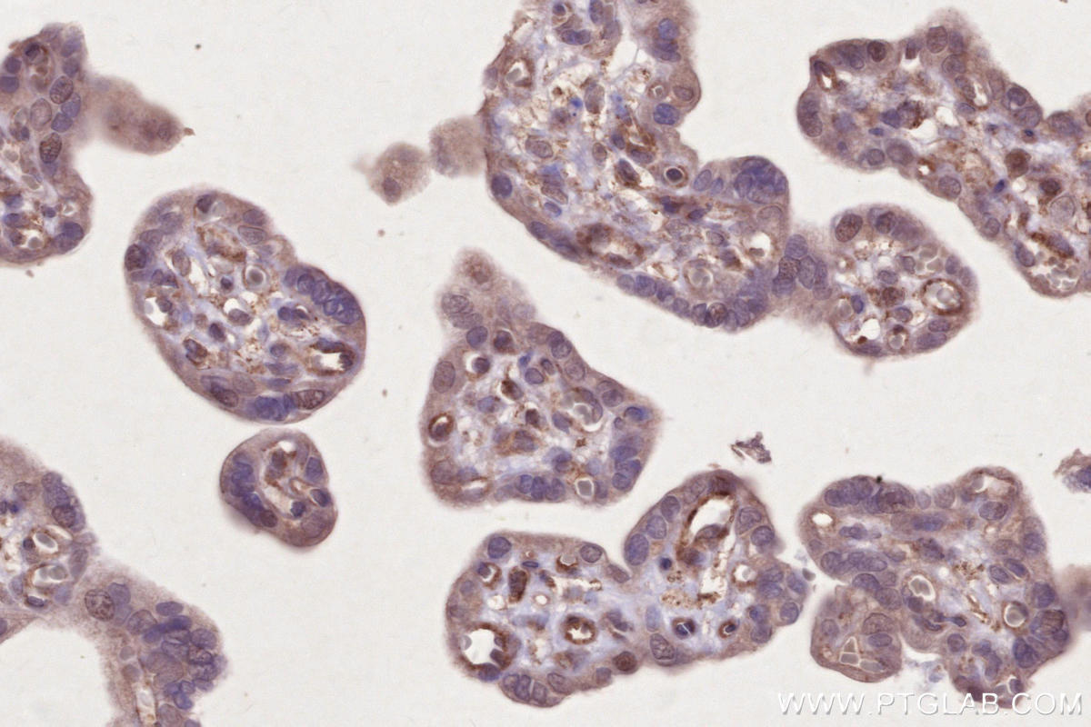 IHC staining of human placenta using 27895-1-AP