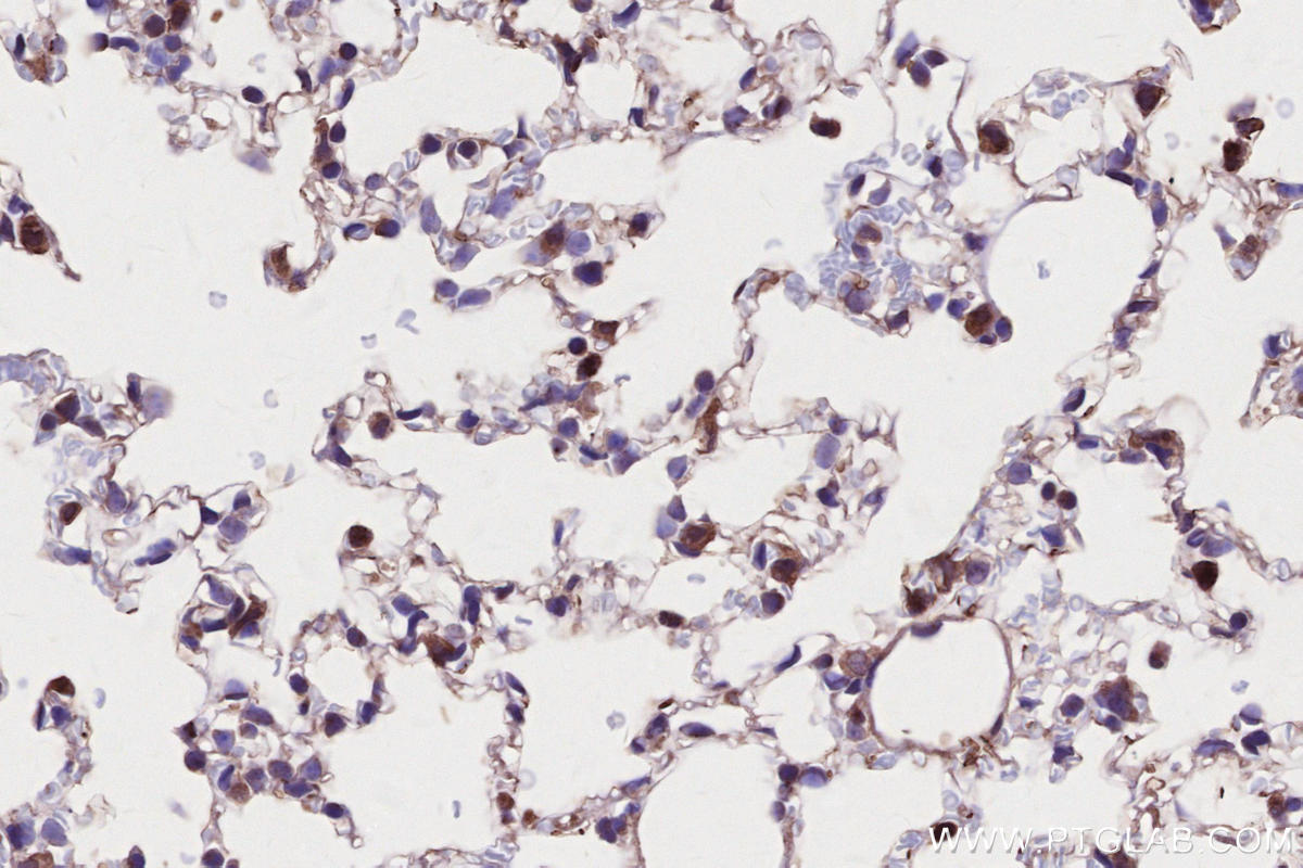 IHC staining of mouse lung using 27895-1-AP