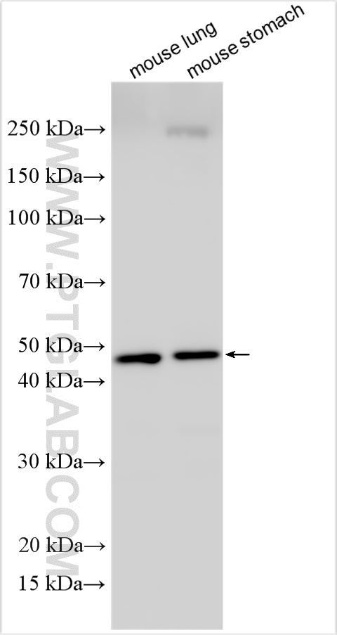 LACC1
