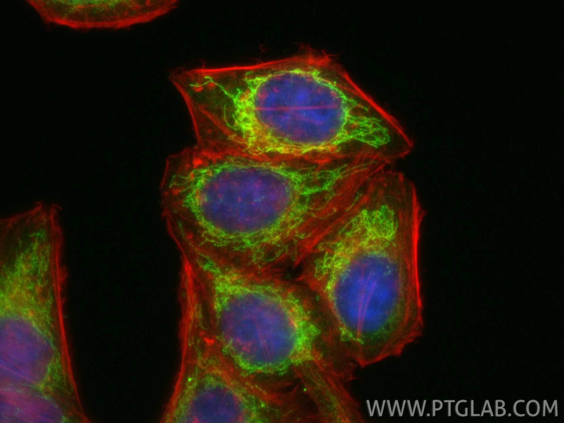 Immunofluorescent analysis of (4% PFA) fixed HepG2 cells using LACE1 antibody (<a class='green' href='/productredirect?CatalogNo=30157-1-AP' target='_blank'>30157-1-AP</a>) at dilution of 1:200 and CoraLite®488-Conjugated Goat Anti-Rabbit IgG(H+L) (<a class='green' href='/productredirect?CatalogNo=SA00013-2' target='_blank'>SA00013-2</a>), CL594-phalloidin (red). This data was developed using the same antibody clone with 30157-1-PBS in a different storage buffer formulation. IF Staining of HepG2 using 30157-1-AP (same clone as 30157-1-PBS)