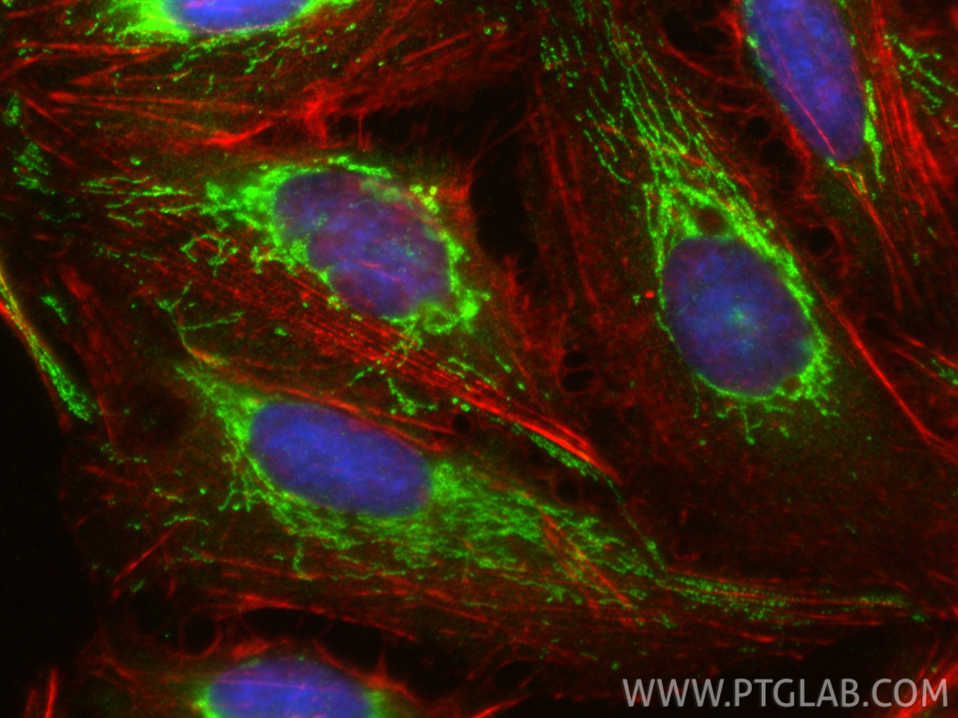 Immunofluorescent analysis of (-20°C Ethanol) fixed U2OS cells using LACE1 antibody (<a class='green' href='/productredirect?CatalogNo=30157-1-AP' target='_blank'>30157-1-AP</a>) at dilution of 1:200 and CoraLite®488-Conjugated Goat Anti-Rabbit IgG(H+L) (<a class='green' href='/productredirect?CatalogNo=SA00013-2' target='_blank'>SA00013-2</a>), CL594-phalloidin (red). This data was developed using the same antibody clone with 30157-1-PBS in a different storage buffer formulation. IF Staining of U2OS using 30157-1-AP (same clone as 30157-1-PBS)