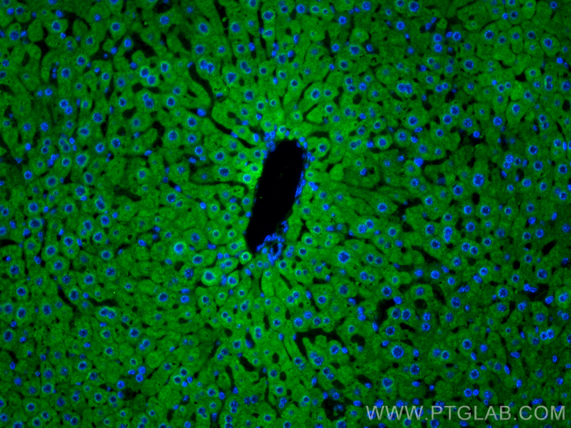 IF Staining of mouse liver using 18195-1-AP
