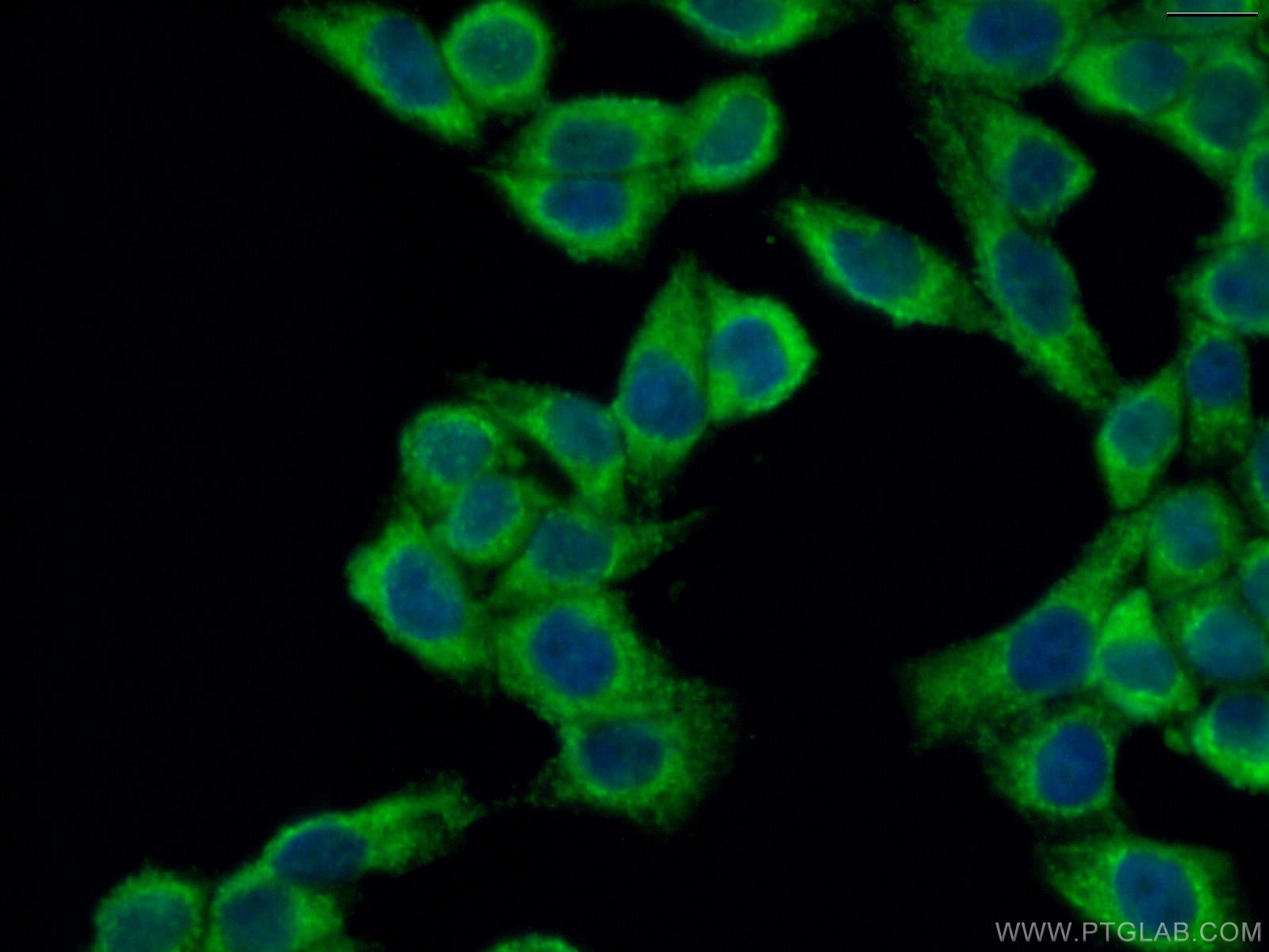 IF Staining of HeLa using 18195-1-AP