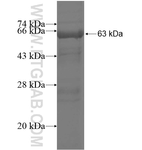 LACTB fusion protein Ag12326 SDS-PAGE LACTB fusion protein Ag12326 SDS-PAGE