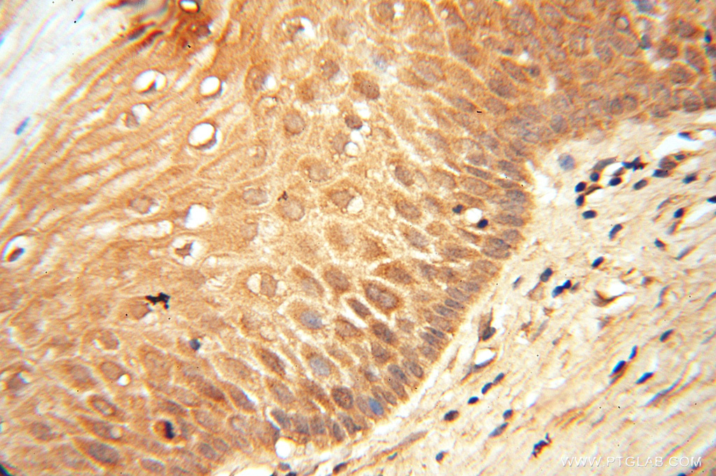 IHC staining of human cervix using 16783-1-AP