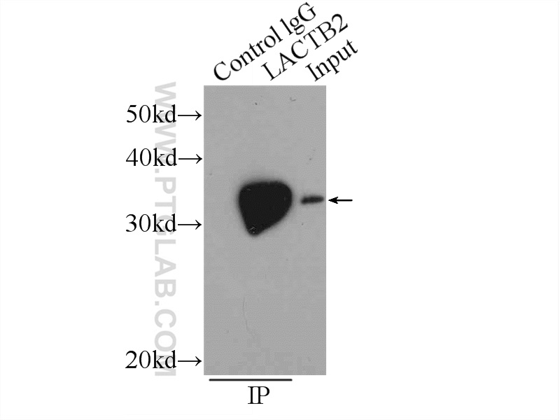 IP experiment of A549 using 16783-1-AP