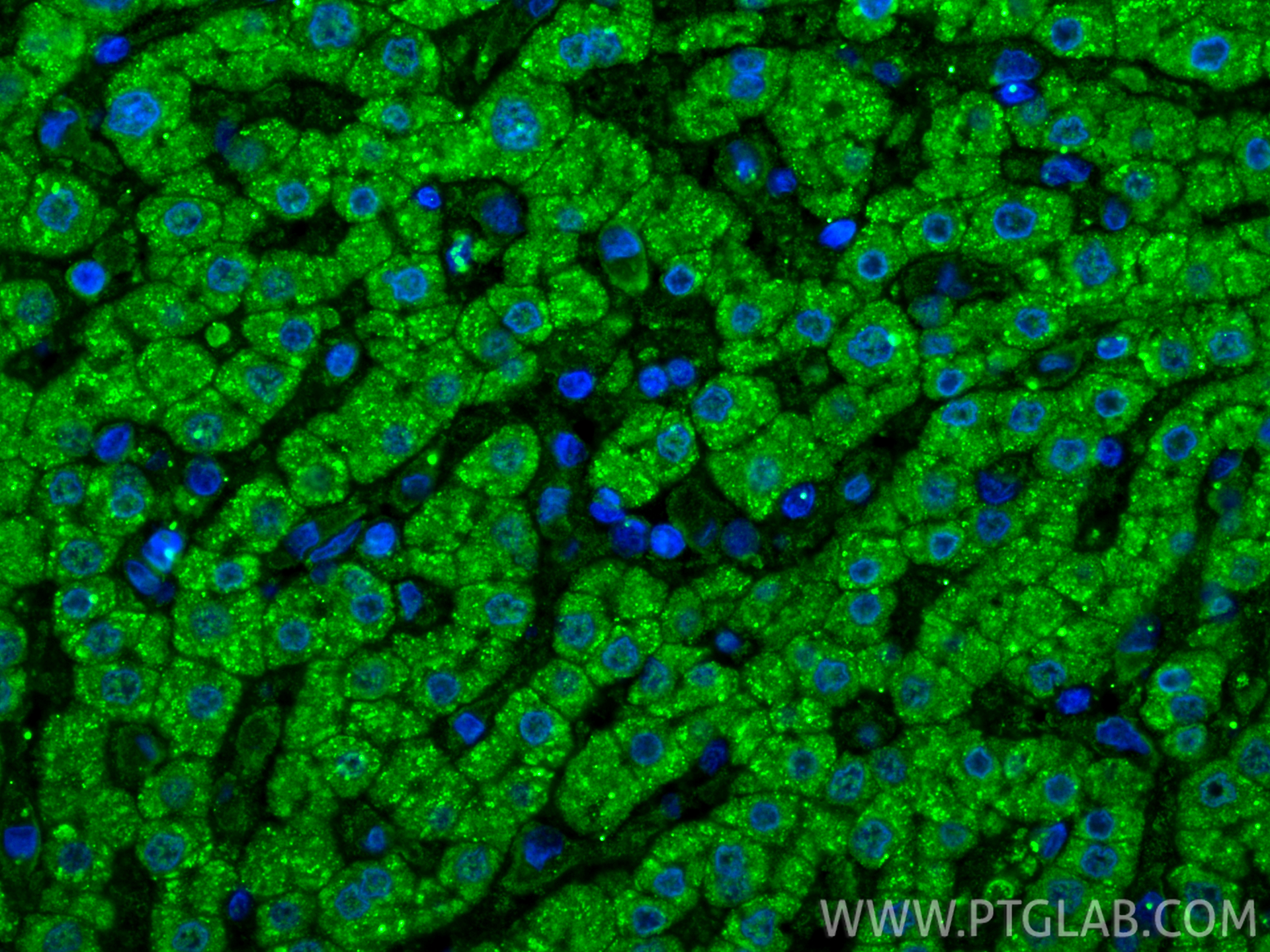 IF Staining of human liver using 67399-1-Ig IF Staining of human liver using 67399-1-Ig