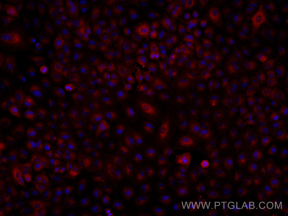 IF Staining of A549 using 67399-1-Ig (same clone as 67399-1-PBS)