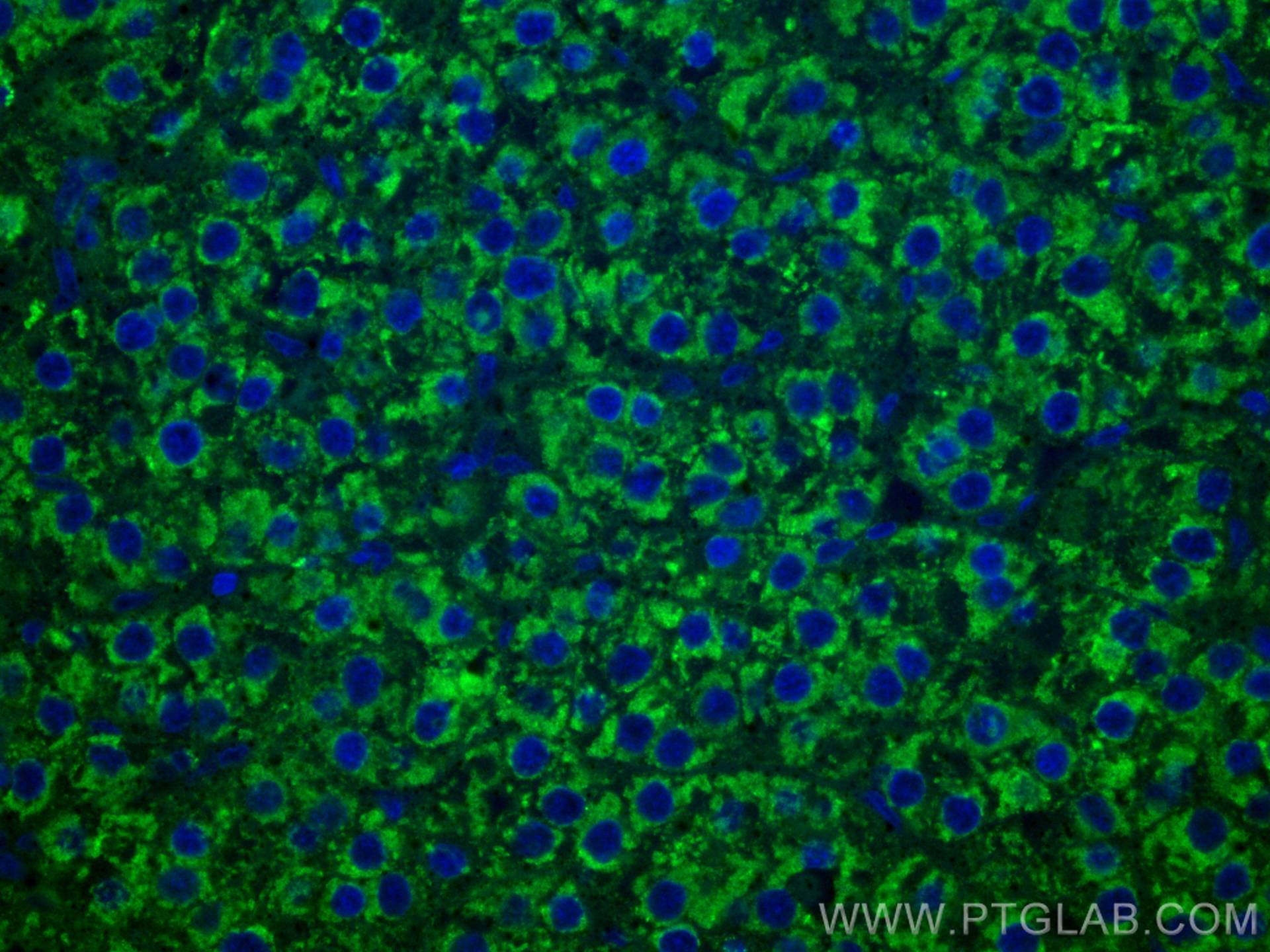 IF Staining of human liver cancer using CL488-67399