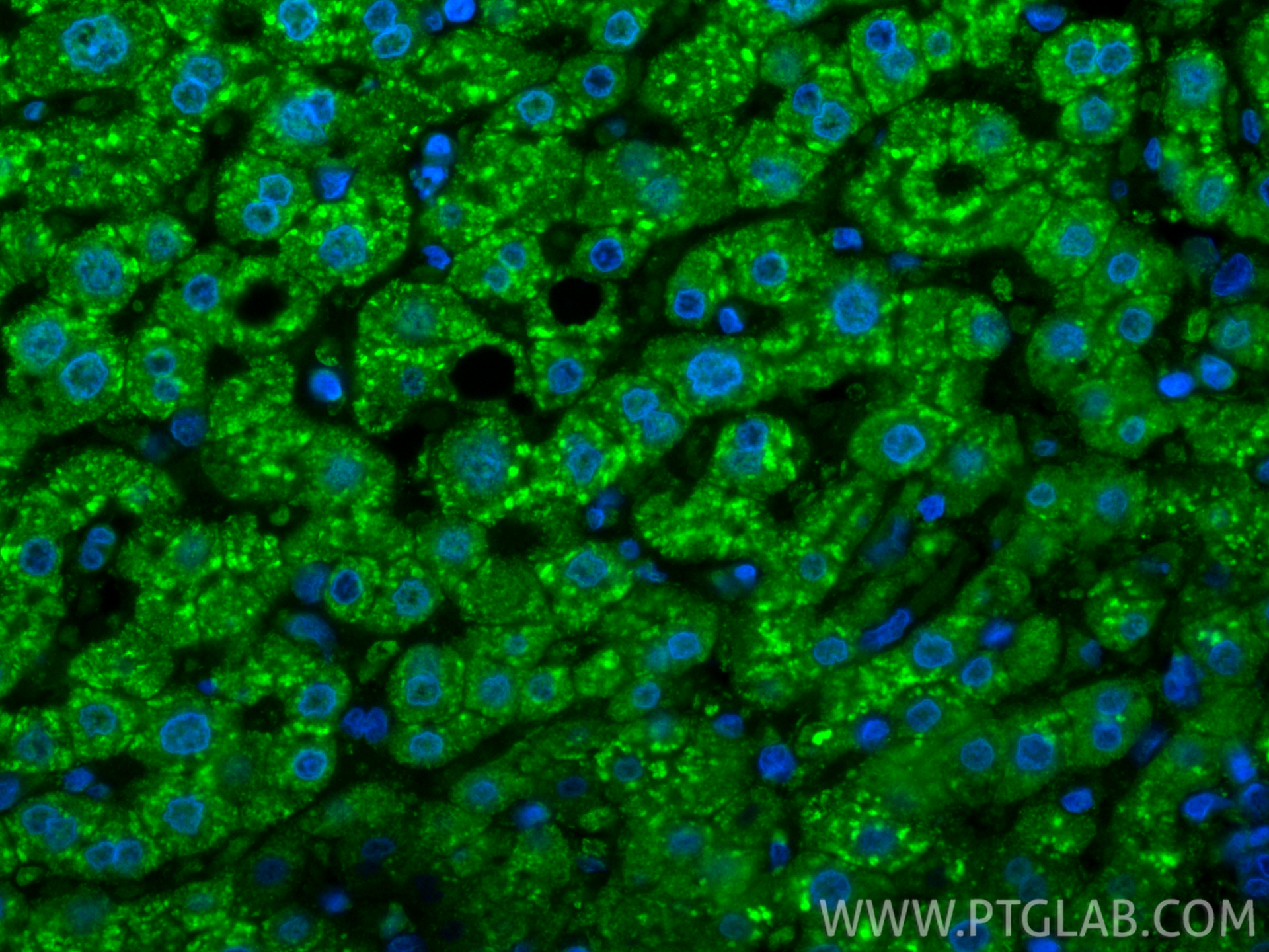 IF Staining of human liver using CL488-67399 IF Staining of human liver using CL488-67399