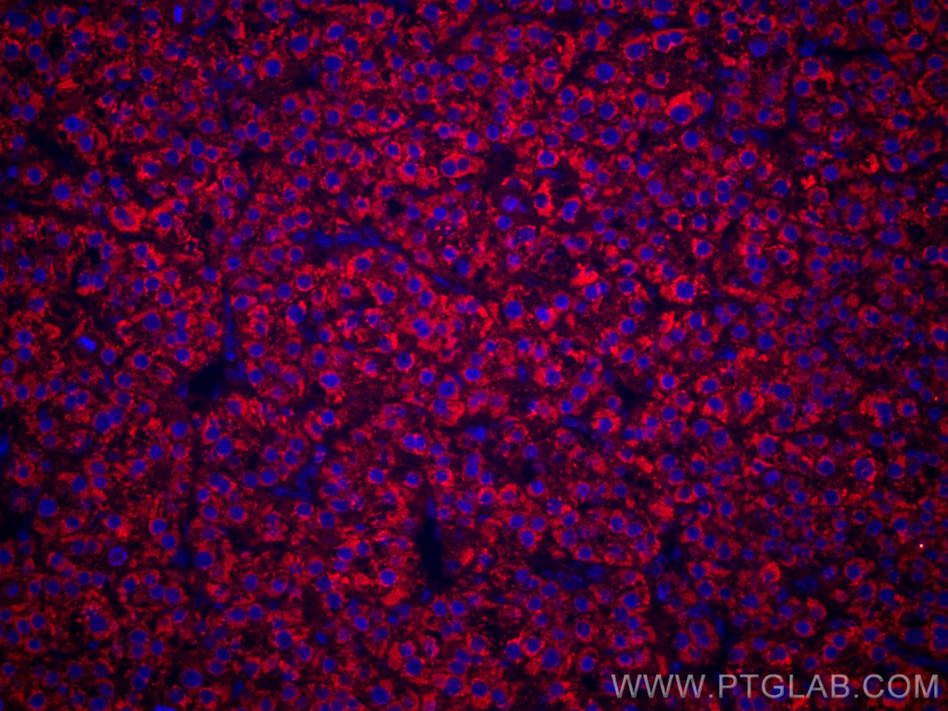 IF Staining of human liver cancer using CL594-67399