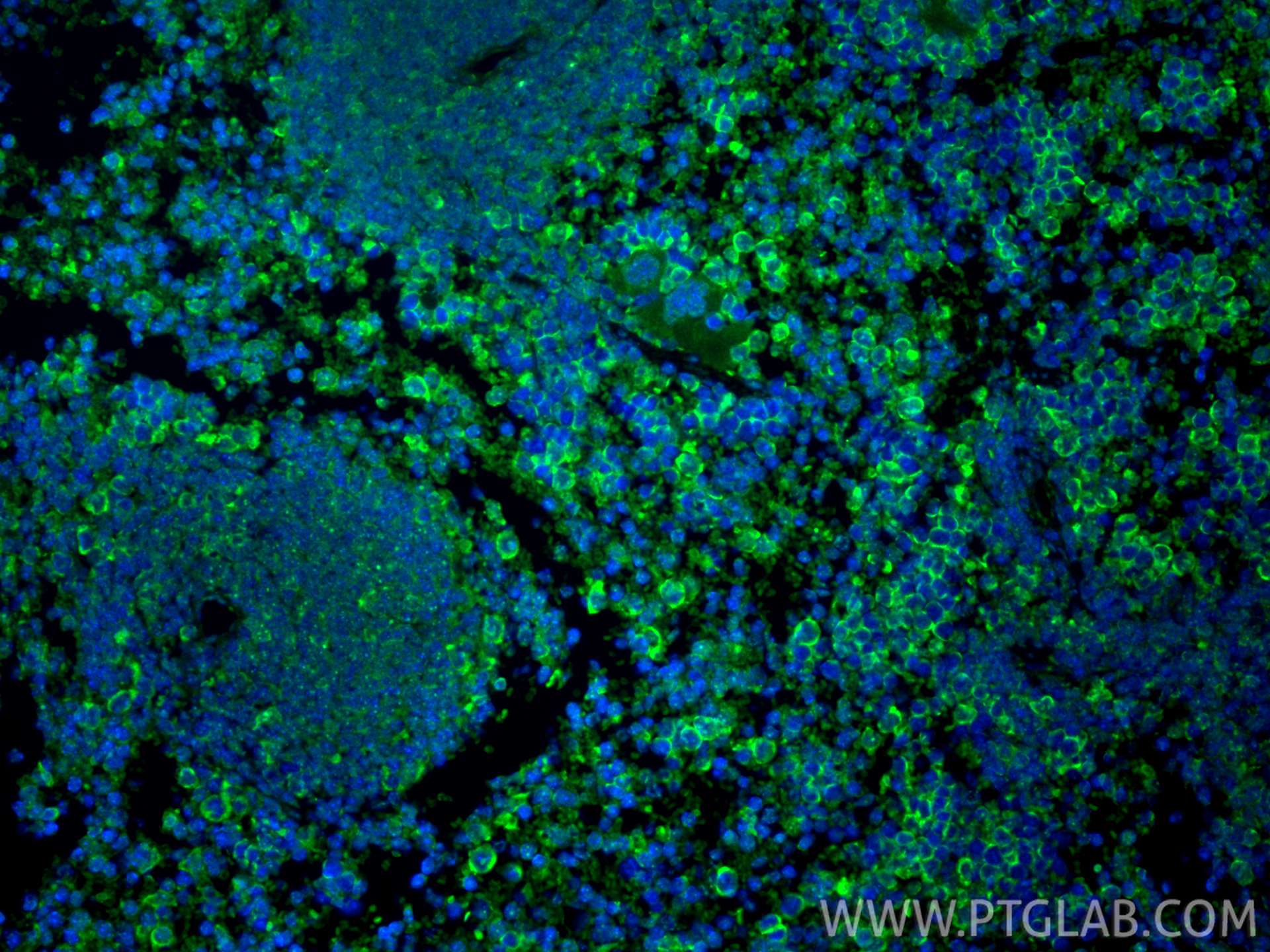 Immunofluorescent analysis of (4% PFA) fixed paraffin-embedded mouse spleen tissue using LAG-3/CD223 antibody (31722-1-AP) at dilution of 1:400 and CoraLite®488-Conjugated Goat Anti-Rabbit IgG(H+L) (<a class='green' href='/productredirect?CatalogNo=SA00013-2' target='_blank'>SA00013-2</a>). Heat mediated antigen retrieval with Tris-EDTA buffer (pH 9.0). IF Staining of mouse spleen using 31722-1-AP
