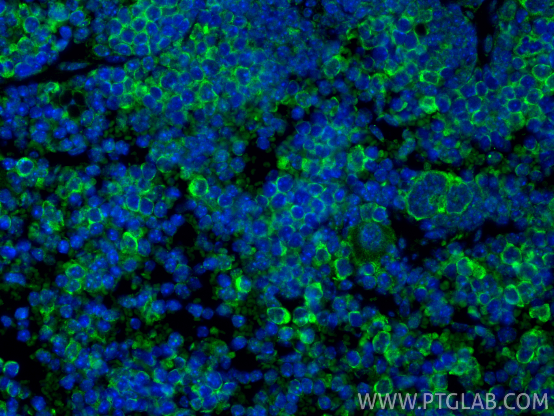 Immunofluorescent analysis of (4% PFA) fixed paraffin-embedded mouse spleen tissue using LAG-3/CD223 antibody (31722-1-AP) at dilution of 1:400 and CoraLite®488-Conjugated Goat Anti-Rabbit IgG(H+L) (<a class='green' href='/productredirect?CatalogNo=SA00013-2' target='_blank'>SA00013-2</a>). Heat mediated antigen retrieval with Tris-EDTA buffer (pH 9.0). IF Staining of mouse spleen using 31722-1-AP