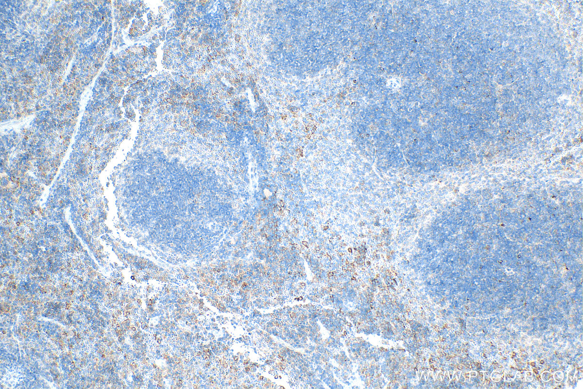 Immunohistochemical analysis of paraffin-embedded mouse spleen tissue slide using 31722-1-AP (LAG-3/CD223 antibody) at dilution of 1:400 (under 10x lens). Heat mediated antigen retrieval with Tris-EDTA buffer (pH 9.0). IHC staining of mouse spleen using 31722-1-AP