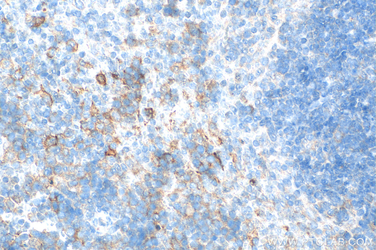 Immunohistochemical analysis of paraffin-embedded mouse spleen tissue slide using 31722-1-AP (LAG-3/CD223 antibody) at dilution of 1:400 (under 40x lens). Heat mediated antigen retrieval with Tris-EDTA buffer (pH 9.0). IHC staining of mouse spleen using 31722-1-AP