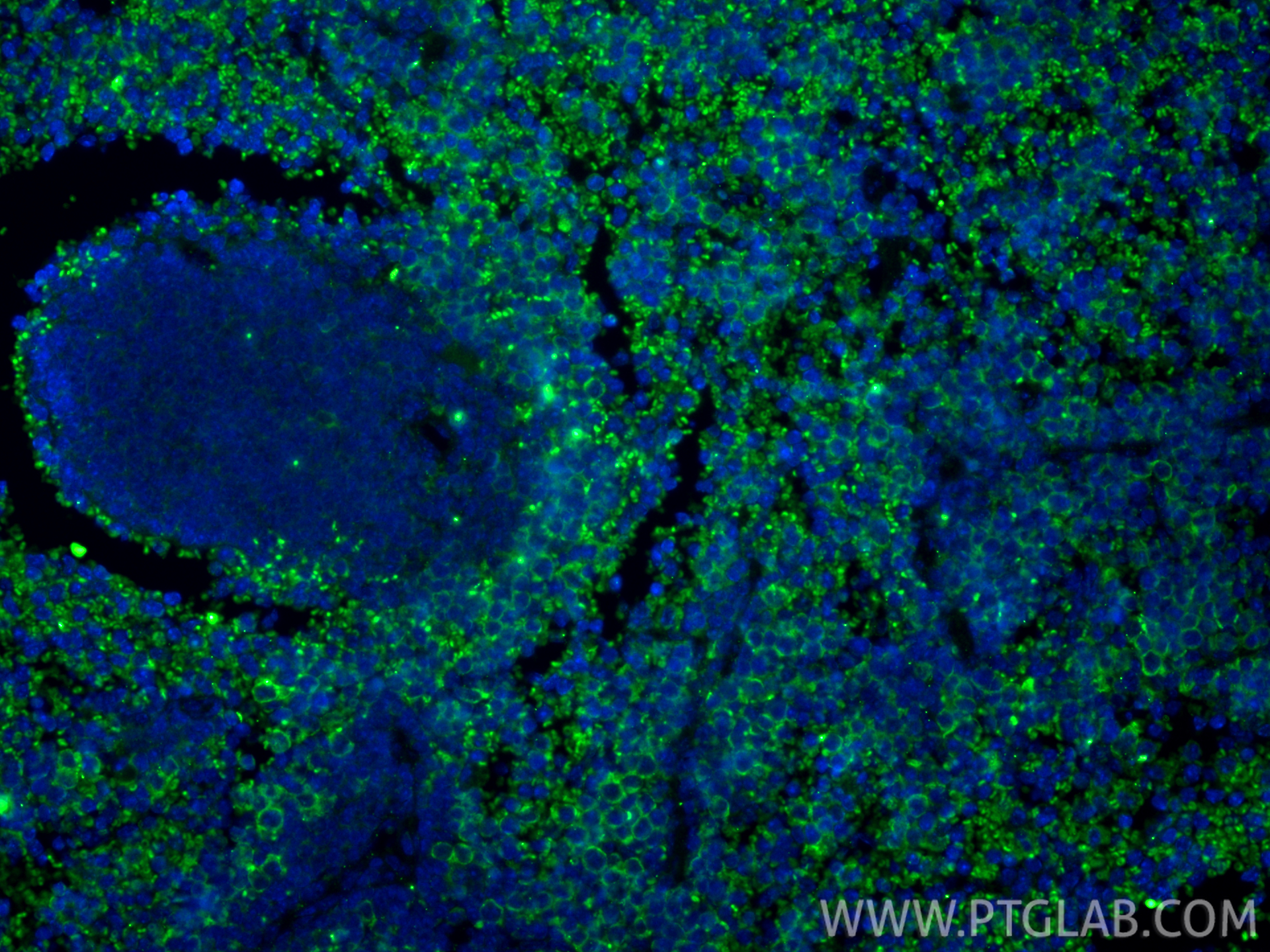 IF Staining of mouse spleen using 83941-7-RR