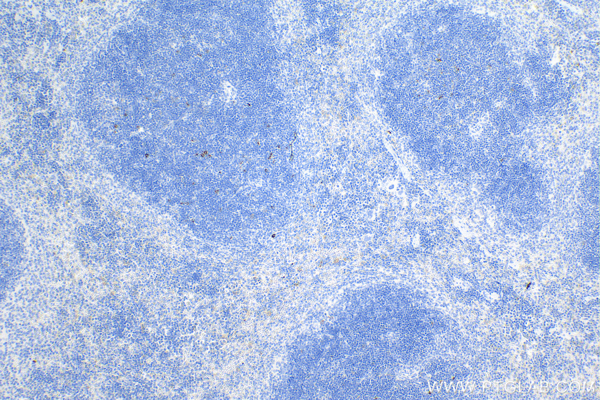 IHC staining of mouse spleen using 83941-7-RR (same clone as 83941-7-PBS)