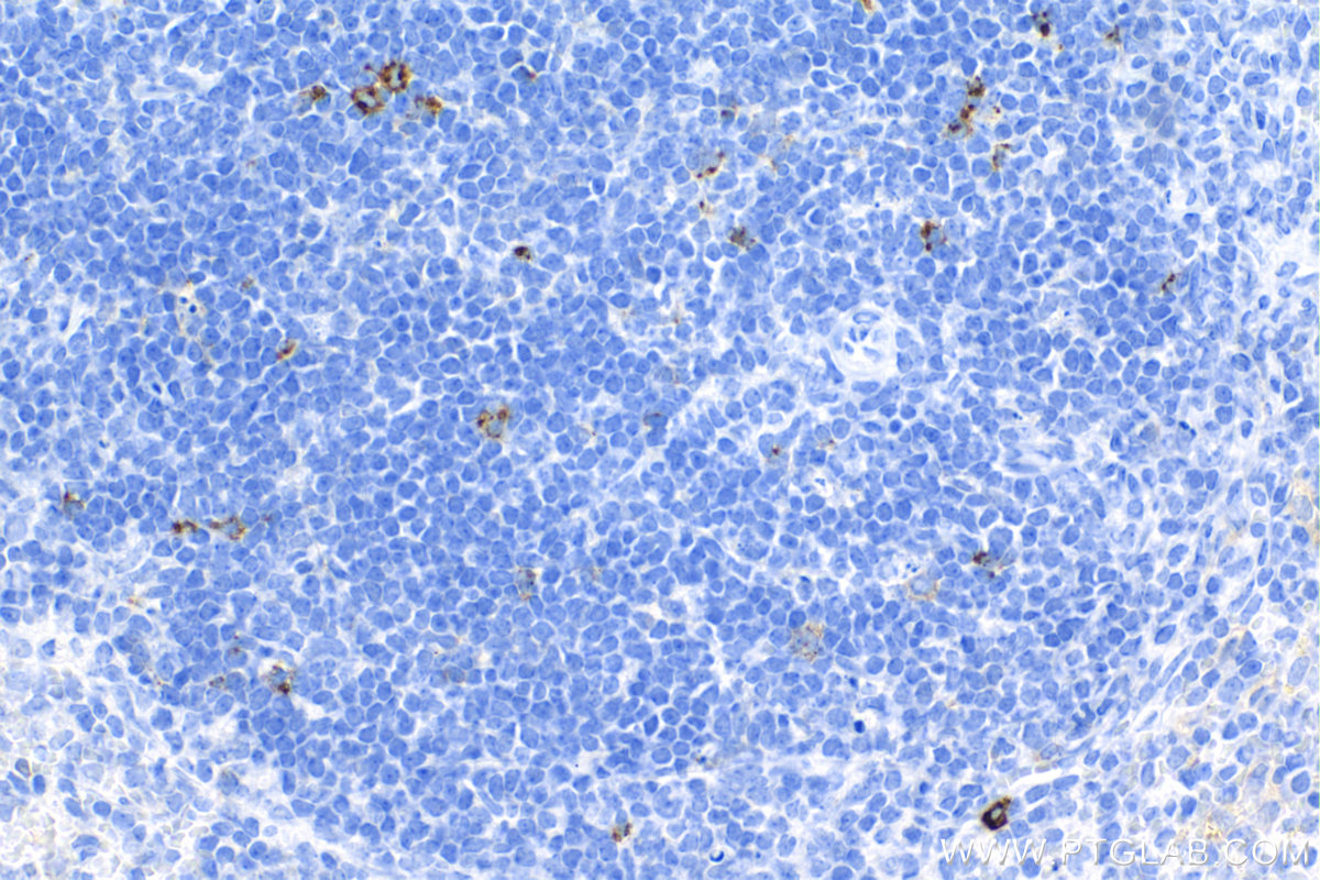 IHC staining of mouse spleen using 83941-7-RR (same clone as 83941-7-PBS)