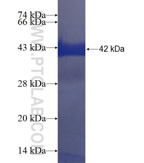 LAG3 fusion protein Ag9661 SDS-PAGE LAG3 fusion protein Ag9661 SDS-PAGE