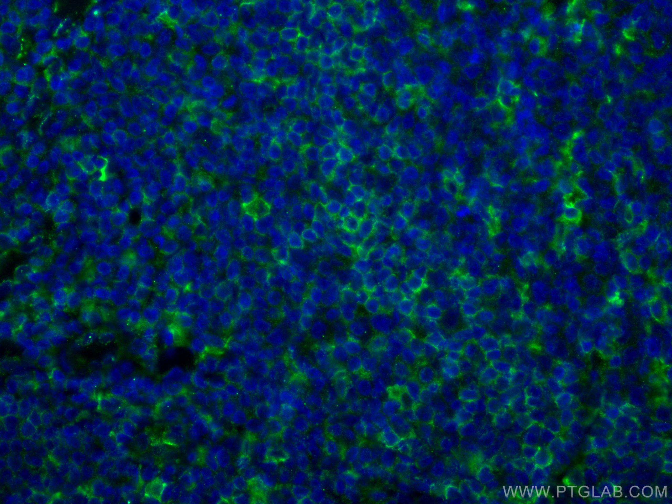IF Staining of human tonsillitis using 67220-1-Ig