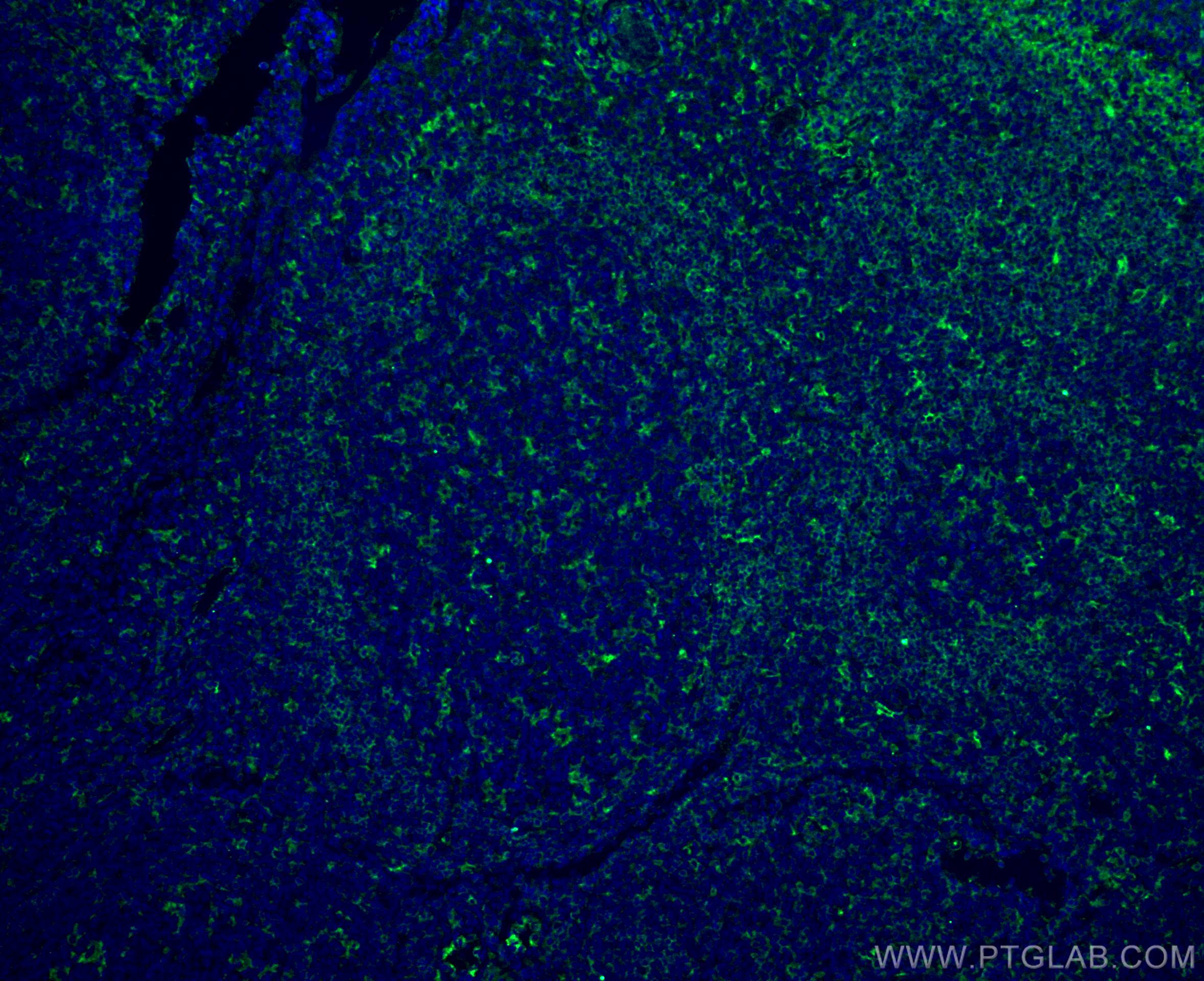 IF Staining of human tonsillitis using 67220-1-Ig
