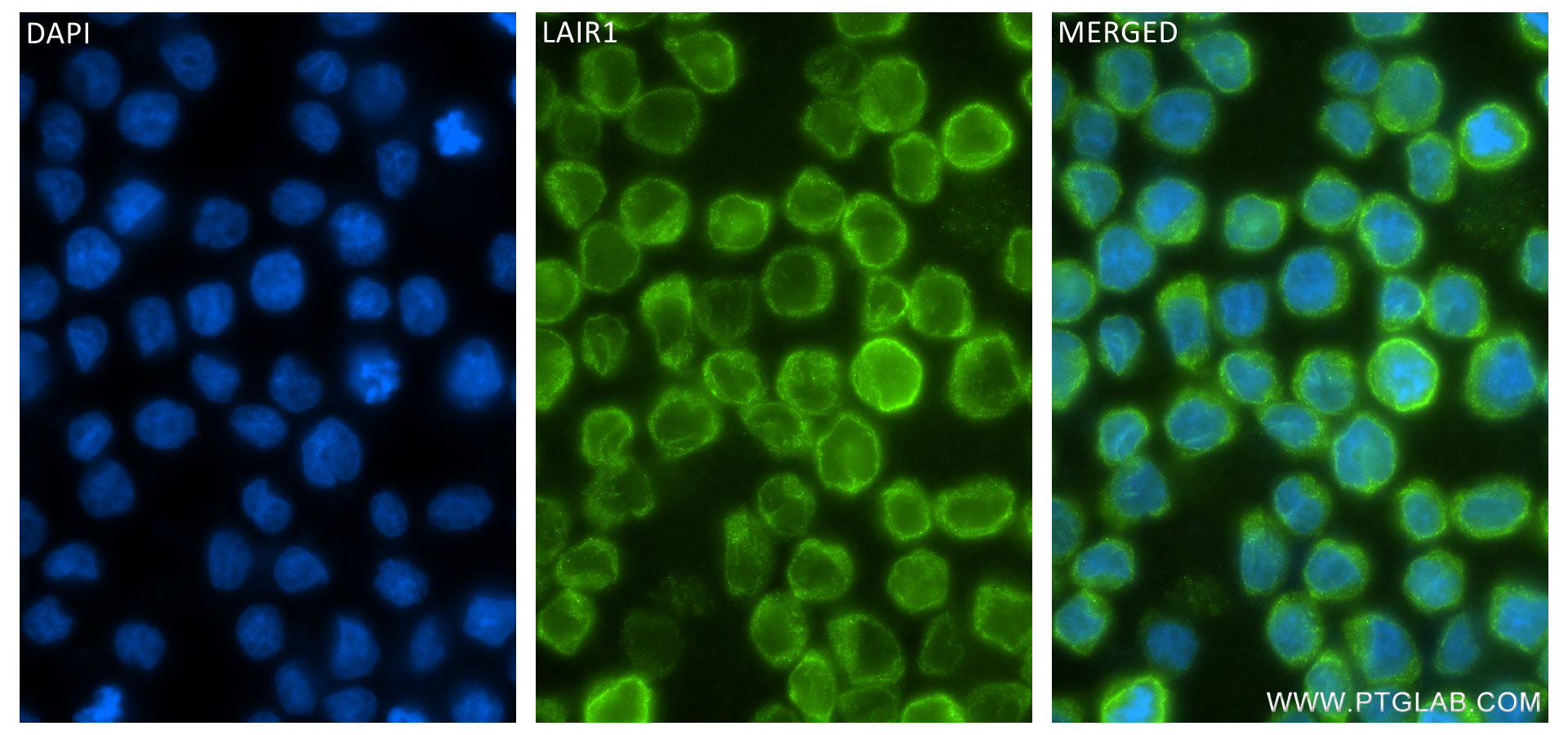 IF Staining of THP-1 using 84677-4-RR