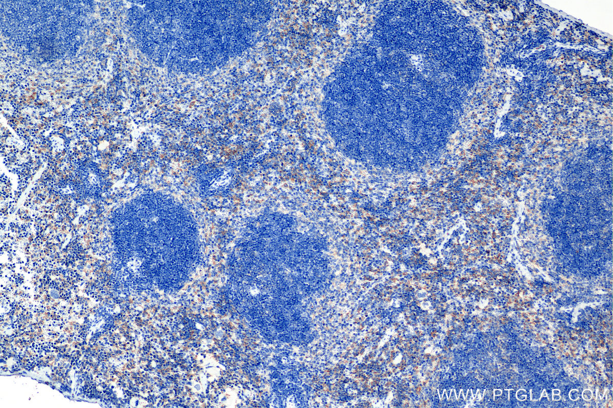 IHC staining of mouse spleen using 85010-1-RR