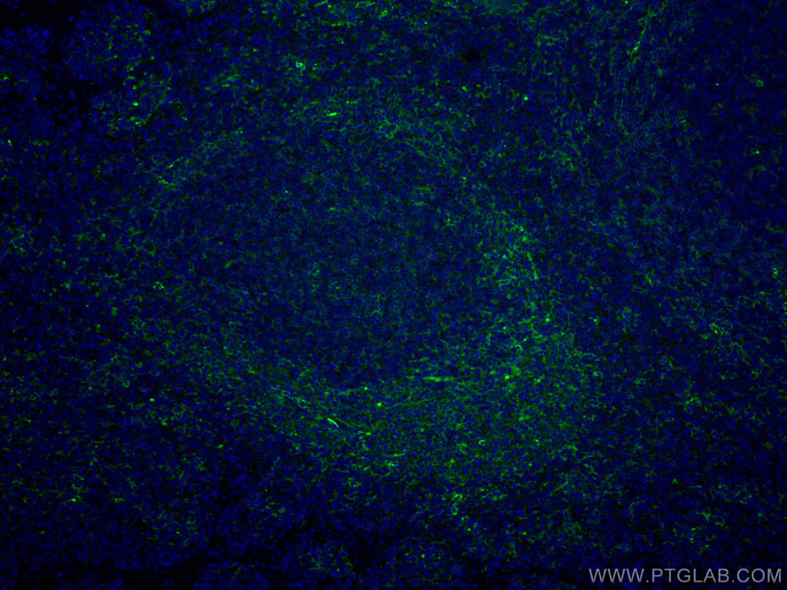 IF Staining of human tonsillitis using CL488-67220