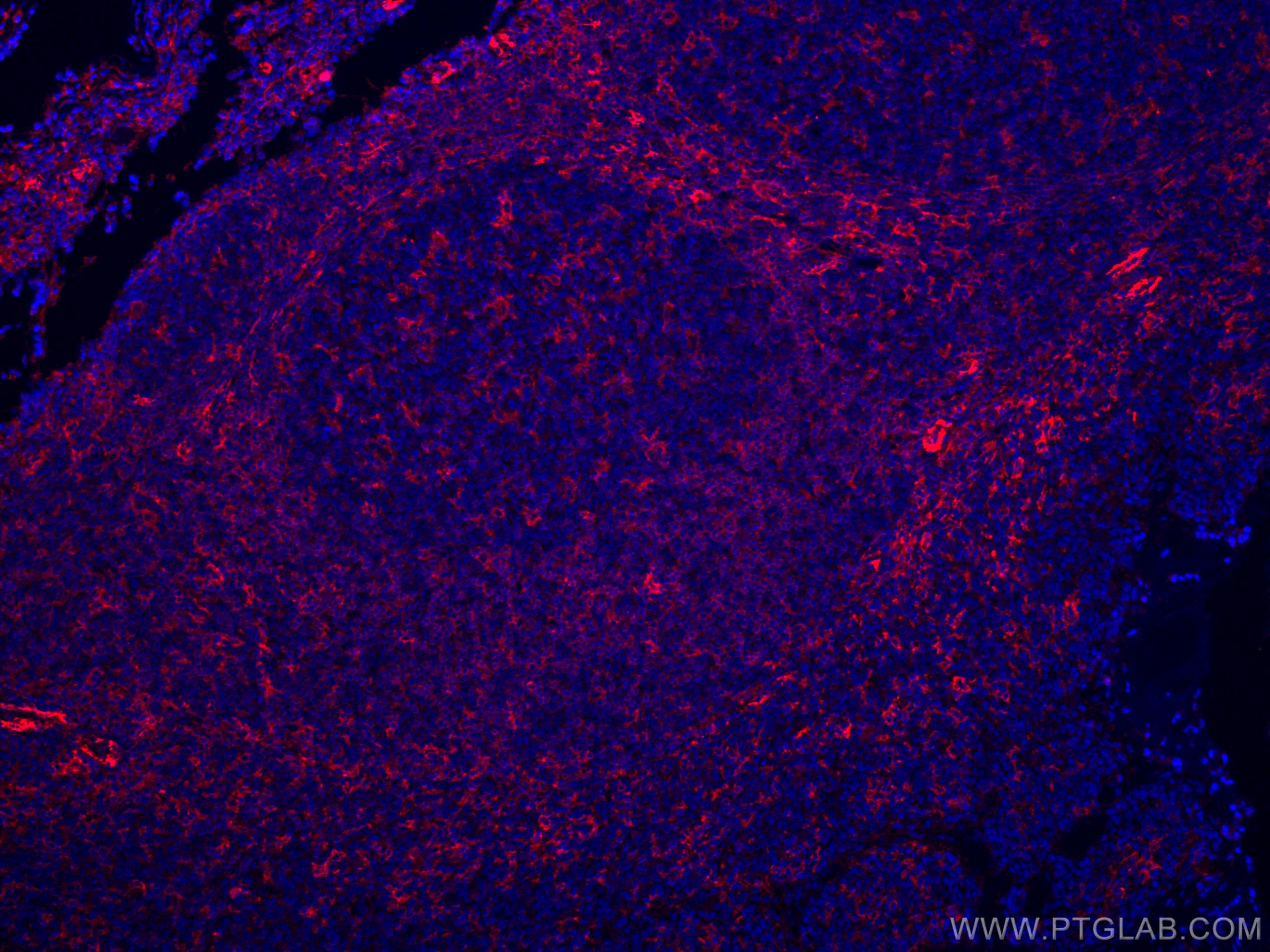 IF Staining of human tonsillitis using CL594-67220