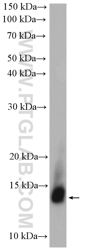 WB analysis of human saliva using 24871-1-AP