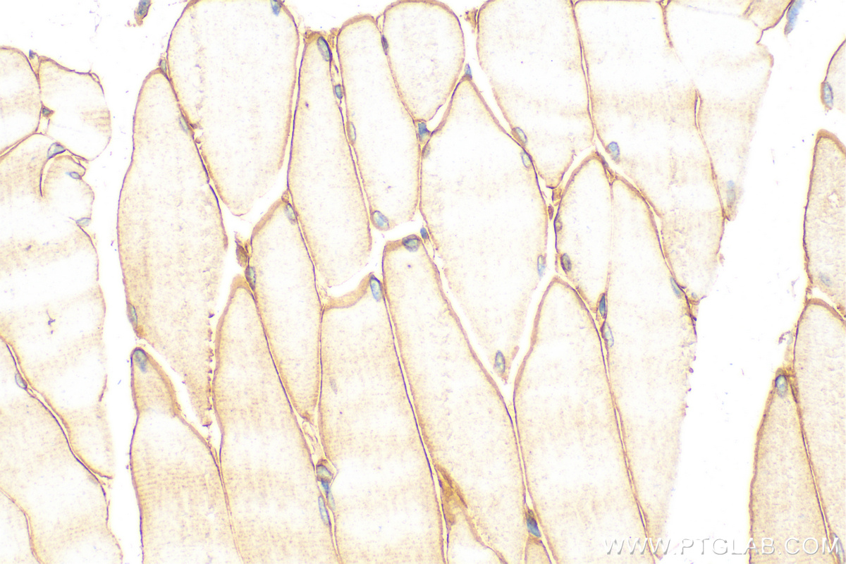 IHC staining of mouse skeletal muscle using 31181-1-AP