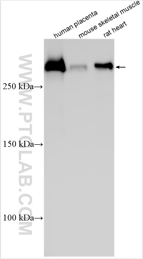 WB analysis using 31181-1-AP