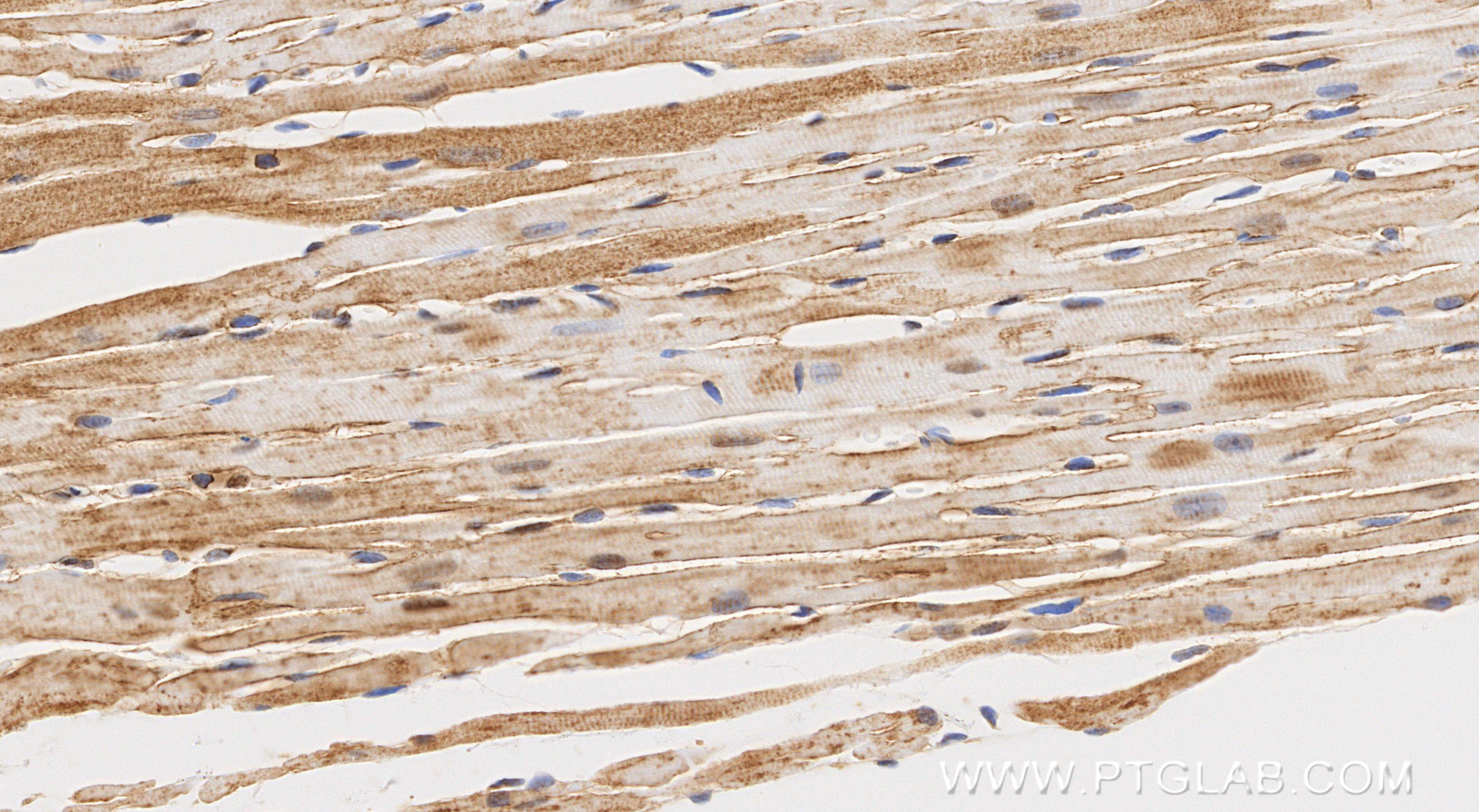 IHC staining of mouse heart using 83007-2-RR