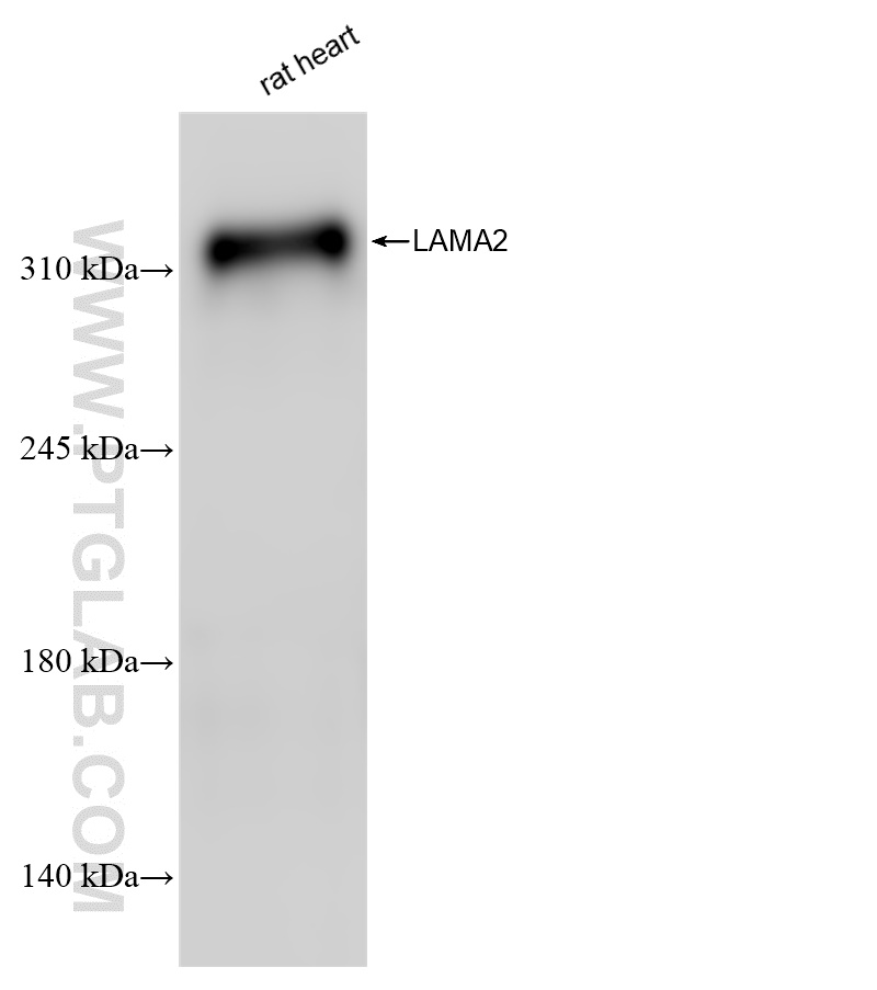 WB analysis using 83007-2-RR (same clone as 83007-2-PBS)