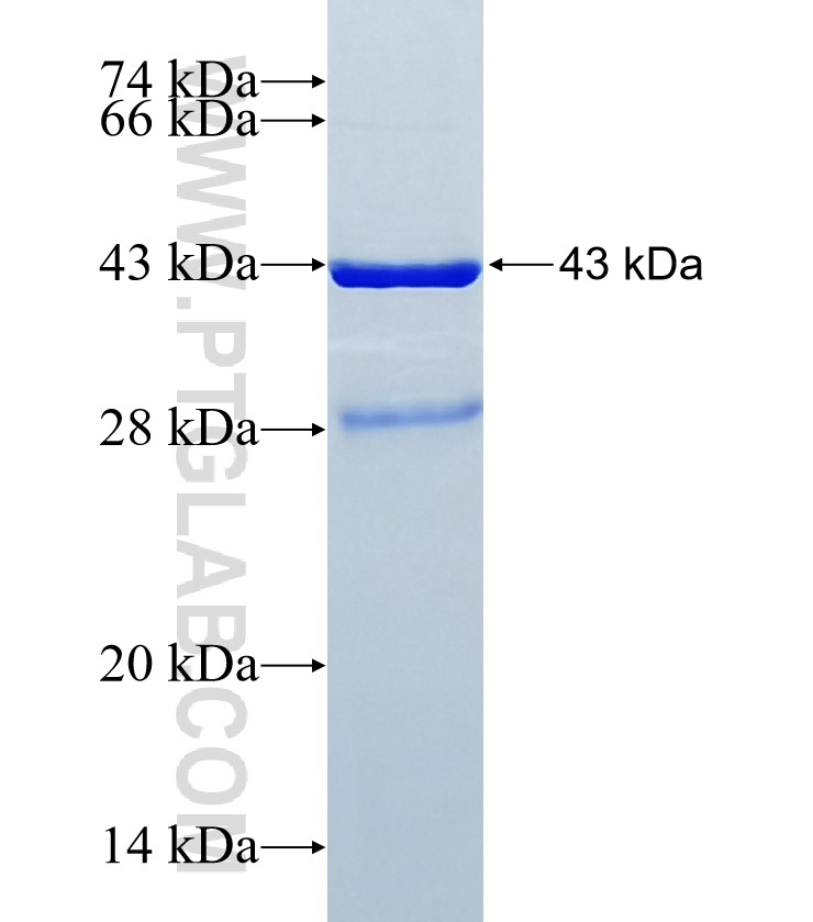 LAMA2 fusion protein Ag34494 SDS-PAGE