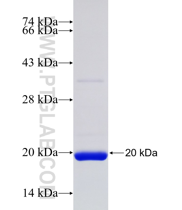 LAMA2 fusion protein Ag34528 SDS-PAGE