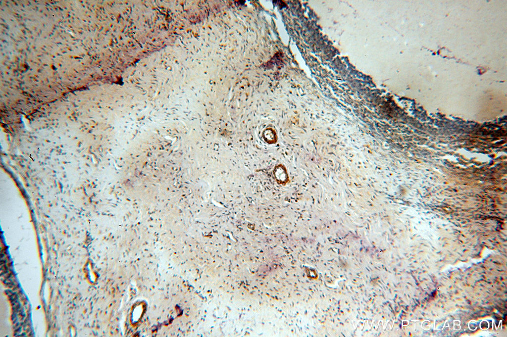 IHC staining of human ovary using 10465-1-AP