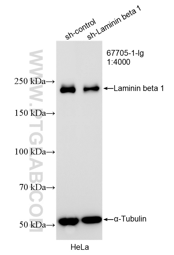 WB result of Laminin beta 1 antibody (67705-1-Ig; 1:4000; incubated at room temperature for 1.5 hours) with sh-Control and sh-Laminin beta 1 transfected HeLa cells. WB analysis of HeLa using 67705-1-Ig