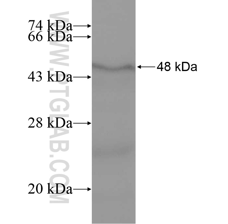 LAMB3 fusion protein Ag10317 SDS-PAGE LAMB3 fusion protein Ag10317 SDS-PAGE