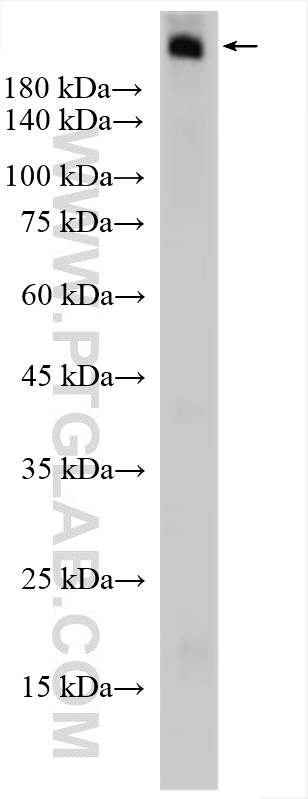 WB analysis of mouse skin using 25217-1-AP